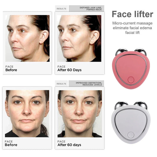 Electric Face Lifting Roller - EMS Microcurrent