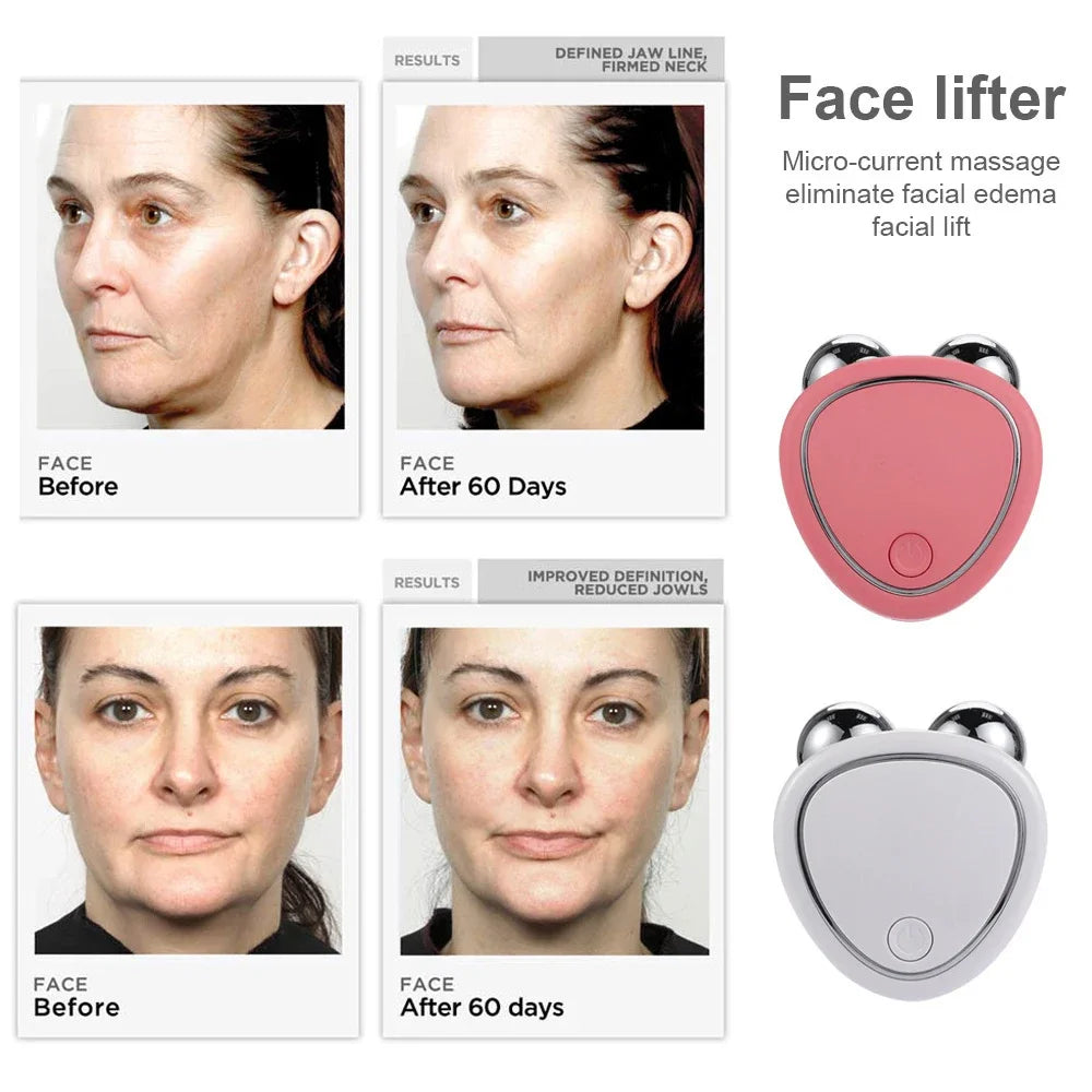 Electric Face Lifting Roller - EMS Microcurrent